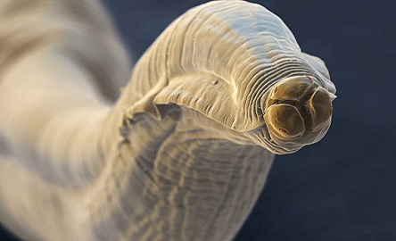 В каждом пятом жителе Земли живут черви-паразиты – ученые