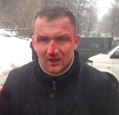 Свежие новости: Избиение Левченко: появилось провокационное видео с нардепом