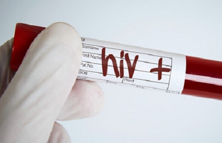 Свежие новости: В Николаеве растет показатель распространенности ВИЧ-инфекции