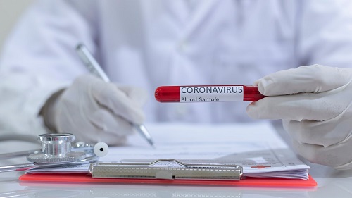 Свежие новости: Минздрав обновил алгоритм тестирования на коронавирус: что изменилось