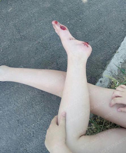 Свежие новости: В Николаеве «скорая» сбила ребёнка