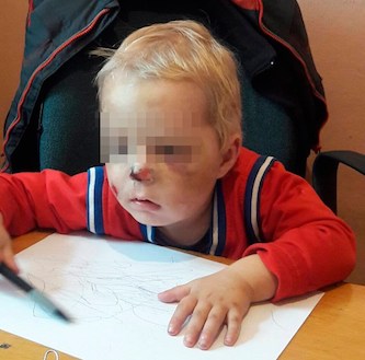 Свежие новости: На Житомирщине мать жестоко избила двухлетнего сына: у ребенка сотрясение мозга и сломан нос