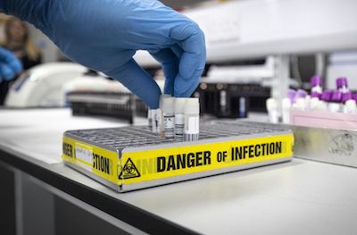 Свежие новости: Названа возможная причина повторного заражения коронавирусом