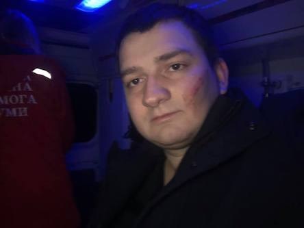 Свежие новости: СБУ инсценировала нападение на нардепа от «Слуги народа» Ананченко