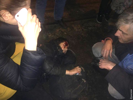 Свежие новости: ФОТО. ДТП в Одессе:  пострадал 12-летний мальчик