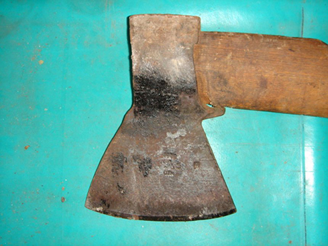 Свежие новости: На Полтавщине дети уронили двухлетней девочке на руку топор