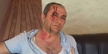 Свежие новости: ВИДЕО: Инвалид Карабахской войны сжег свой дом в знак протеста