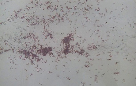 Свежие новости: В Одесской области из кранов течет вода с червями