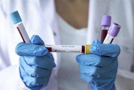 Свежие новости: В Одессе резко выросло количество заболевших коронавирусом