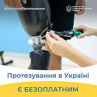 Свежие новости: В Миколаєві державне підприємство безплатно виготовляє протези для людей з інвалідністю