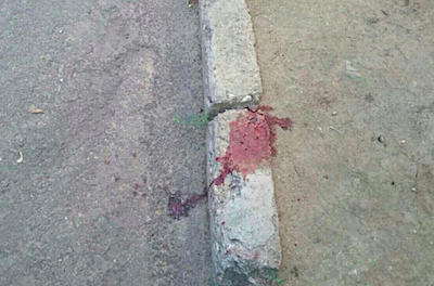 Свежие новости: В Николаеве водитель Hyundai сбила 87-летнего пенсионера