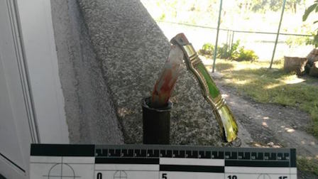 Фото новости: В Николаеве внучка, защищая бабушку от обидчика, получила от него многочисленные ножевые ранения Свежие новости: В Николаеве внучка, защищая бабушку от обидчика, получила от него многочисленные ножевые ранения