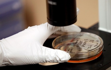 Свежие новости: В Одесской области еще одна вспышка гепатита среди школьников