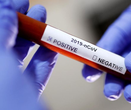 Свежие новости: В Николаевской области за сутки 769 новых случаев COVID