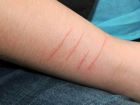 Свежие новости: В Вознесенске родительница на территории школы исцарапала и покусала физрука