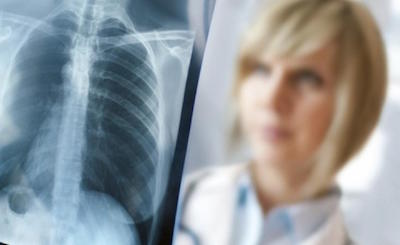 Свежие новости: В Николаеве на ул. Соборной будет работать передвижной флюорограф