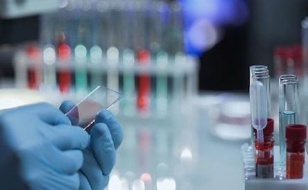 Свежие новости: Новый случай COVID-19 в Николаеве: заболевший «привез» коронавирусную инфекцию из Ровно