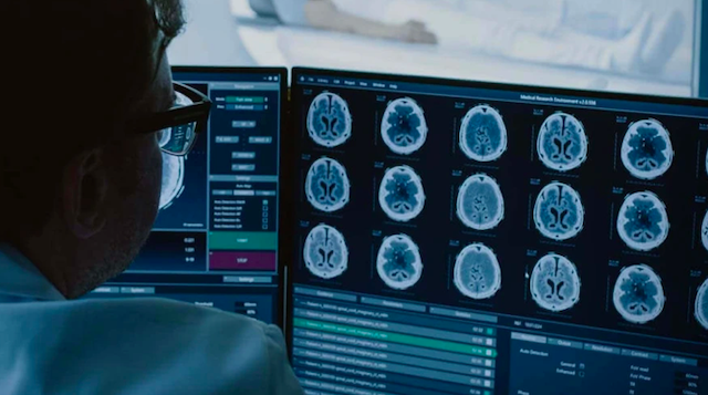 Свежие новости: Гендиректор найбільшої у США мережі державних лікарень хоче замінити рентгенологів ШІ