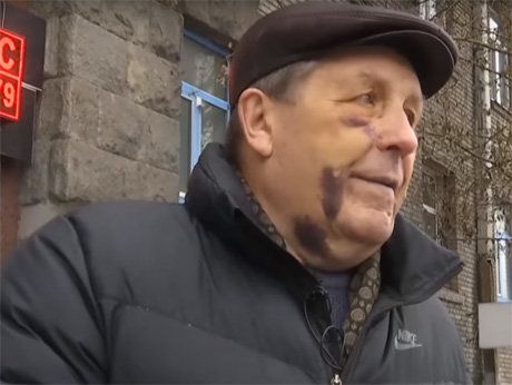 Фото новости: В Киеве неизвестные при поддержке полиции зверски избили соавтора самолета  Свежие новости: В Киеве неизвестные при поддержке полиции зверски избили соавтора самолета