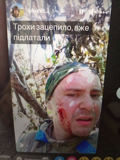 Свежие новости: Член виконкому Миколаївської міськради потрапив під обстріл на фронті