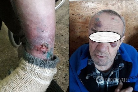 Свежие новости: В Днепропетровской области подопечных психоневрологического интерната насиловали и пытали