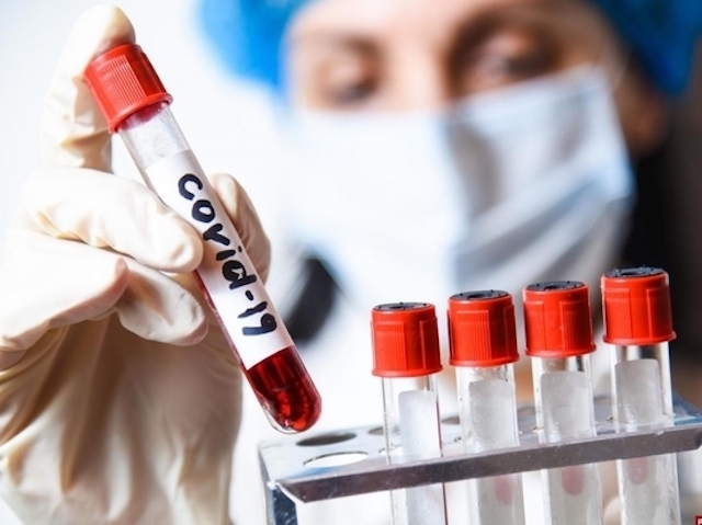 Свежие новости: В Николаевской области показатель заболеваемости COVID-19 превышен почти в два раза