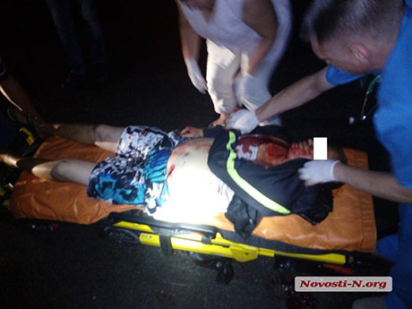 Свежие новости: В результате ночной драки николаевец получил тяжелое ножевое ранение