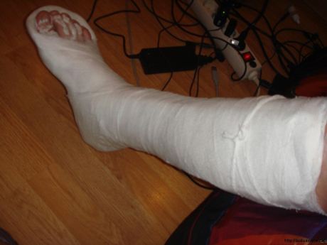 Свежие новости: В Березанке пьяный хулиган сломал ногу полицейскому