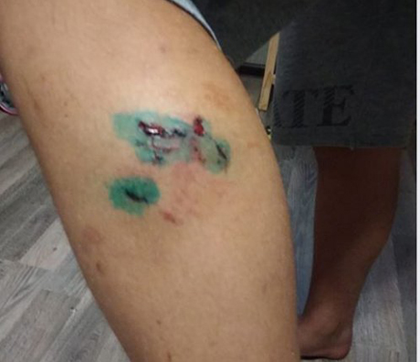 Свежие новости: В Николаеве бродячая собака искусала подростка