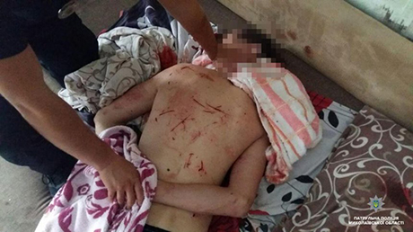 Свежие новости: В Николаеве наркоман изрезал себя ножом и разгромил квартиру