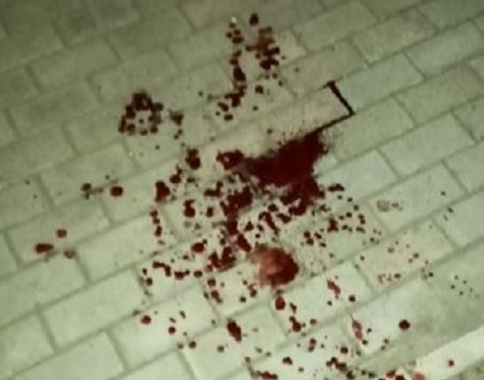 Свежие новости: В николаевском баре наркоман в угаре ударил мужчину ножом в шею, повредив артерию