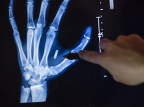 Свежие новости: Тысячи шведов добровольно вживляют чипы себе в руку