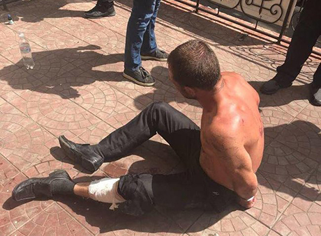 Свежие новости: В Киеве со стрельбой задержали мужчину, который с ножом бросался на патрульных и прохожих