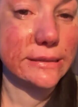 Свежие новости: Внучка поэта Бродского пожаловалась, что в Италии ее избили украинские беженцы