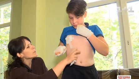 Свежие новости: ВИДЕО: Под Одессой в руках у мальчика взорвалась петарда