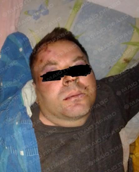 Фото новости: В Новой Одессе хозяин магазина избил мужчину за долг 350 грн и угрожал зарезать всю семью Свежие новости: В Новой Одессе хозяин магазина избил мужчину за долг 350 грн и угрожал зарезать всю семью