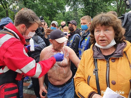 Свежие новости: Мужчина поджег себя на акции против Авакова под Верховной радой