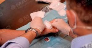 Свежие новости: В Одессе вживили компьютерный чип в руку человеку