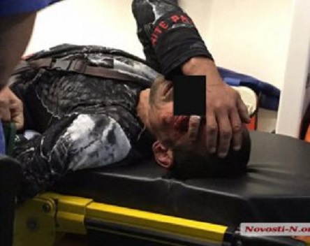 Свежие новости: Поліз на 5 поверх і зірвався. У Миколаєві жінка не пустила п'яного чоловіка додому