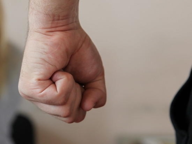 Свежие новости: В Снигиревке злоумышленник до смерти избил односельчанку