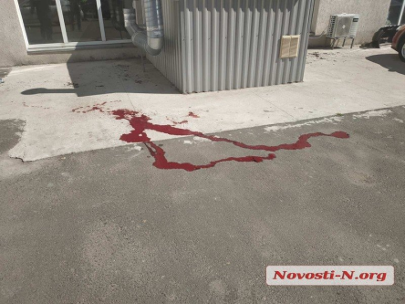 Фото новости: ФОТО: В центре Николаева пулевое ранение в голову получил Михаил Титов по кличке «Мультик» Свежие новости: ФОТО: В центре Николаева пулевое ранение в голову получил Михаил Титов по кличке «Мультик»