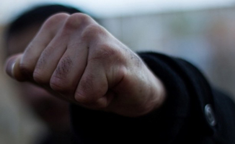 Свежие новости: В Вознесенске ограбили и жестоко избили гражданина Армении – полиция инцидент не комментирует