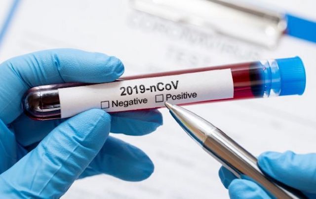 Свежие новости: За сутки в школах Николаева выявили еще 6 случаев COVID-19 среди детей и персонала