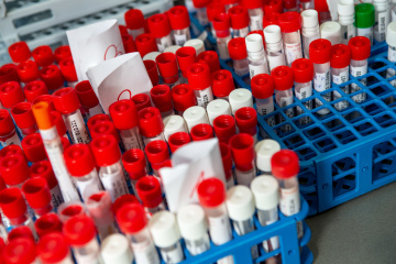 Свежие новости: В Украине за сутки 528 новых случаев COVID-19