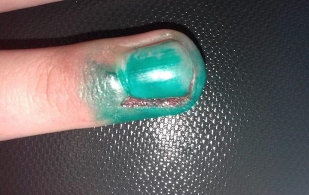 Свежие новости: Столкновения под Одессой: помощник депутата укусил сотрудника полиции