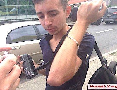 Свежие новости: В Николаеве водитель маршрутки избил журналиста