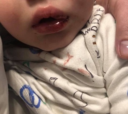 Свежие новости: Пьяная 56-летняя няня в Одессе жестоко избила ребенка