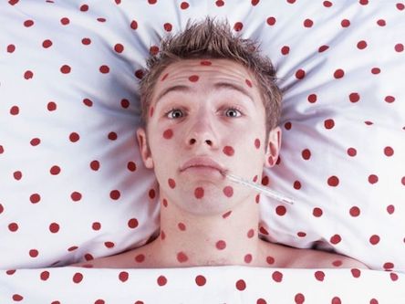 Свежие новости: Вспышка кори в Украине: За прошедшую неделю заболели более 1600 человек