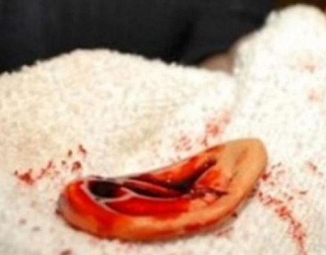 Свежие новости: В Херсоне женщина отрезала ухо мужу прямо за праздничным столом