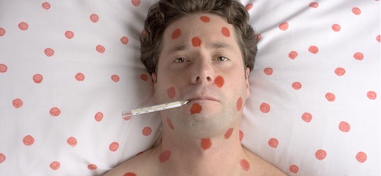 Свежие новости: Інформація про захворювання на кір у місті Вознесенську